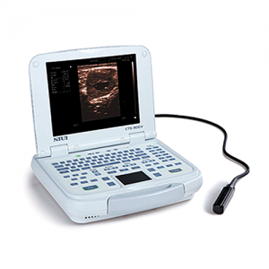 echographe portable CTS 900V echographe portable CTS 900V