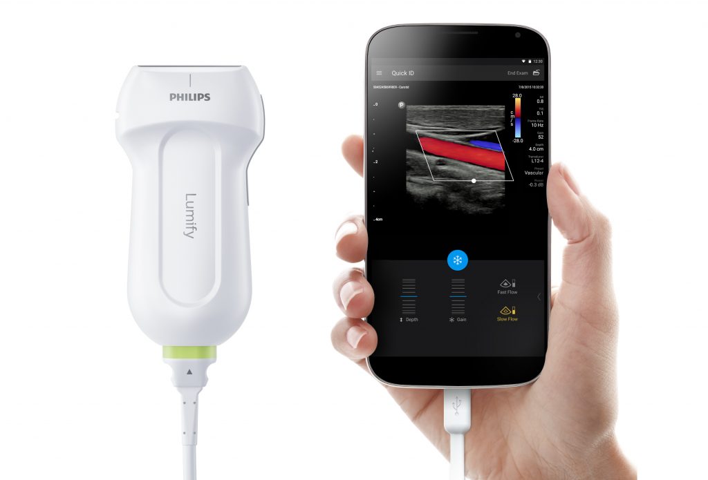 Lumify-Ultra-Mobile-Ultrasound